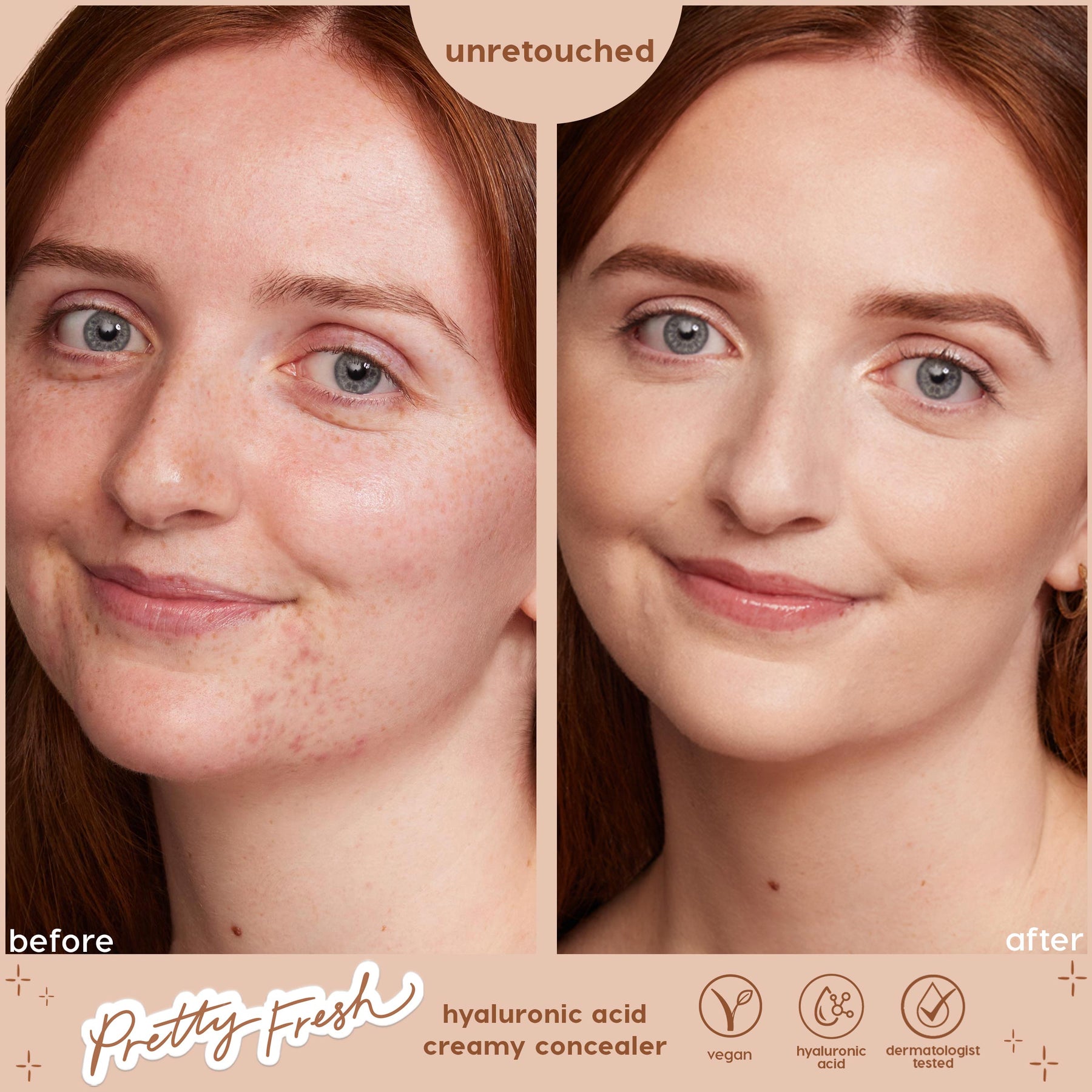 Fair 07 C - Sheer Elevated Complexion Concealer